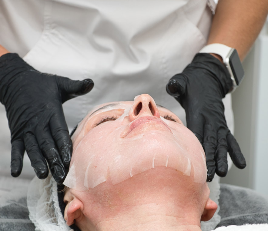 What to Expect During Microneedling Treatments